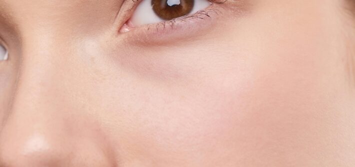 Microneedling-tratamiento-facial
