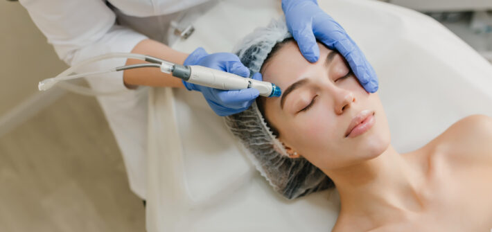 radiofrecuencia facial